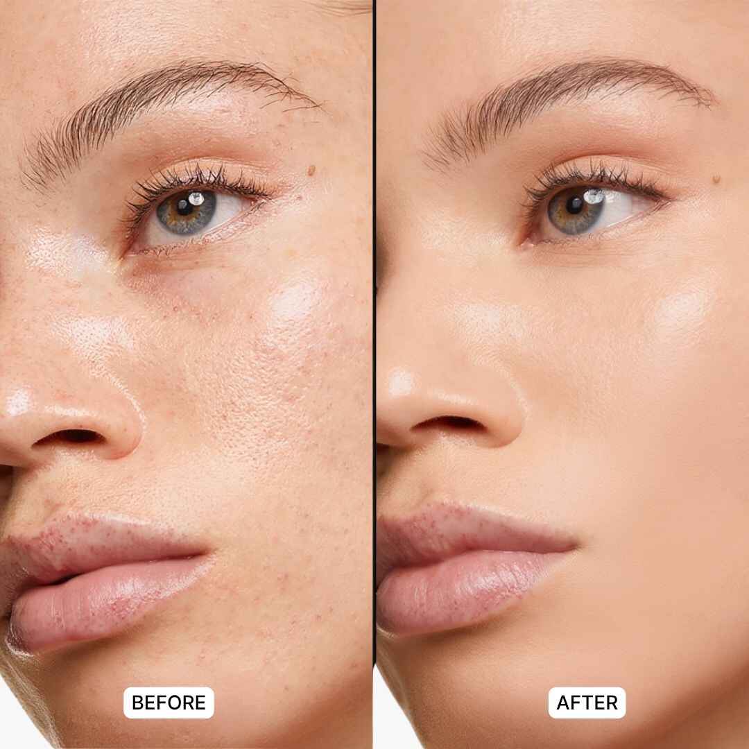 Wide Awake Eye Corrector