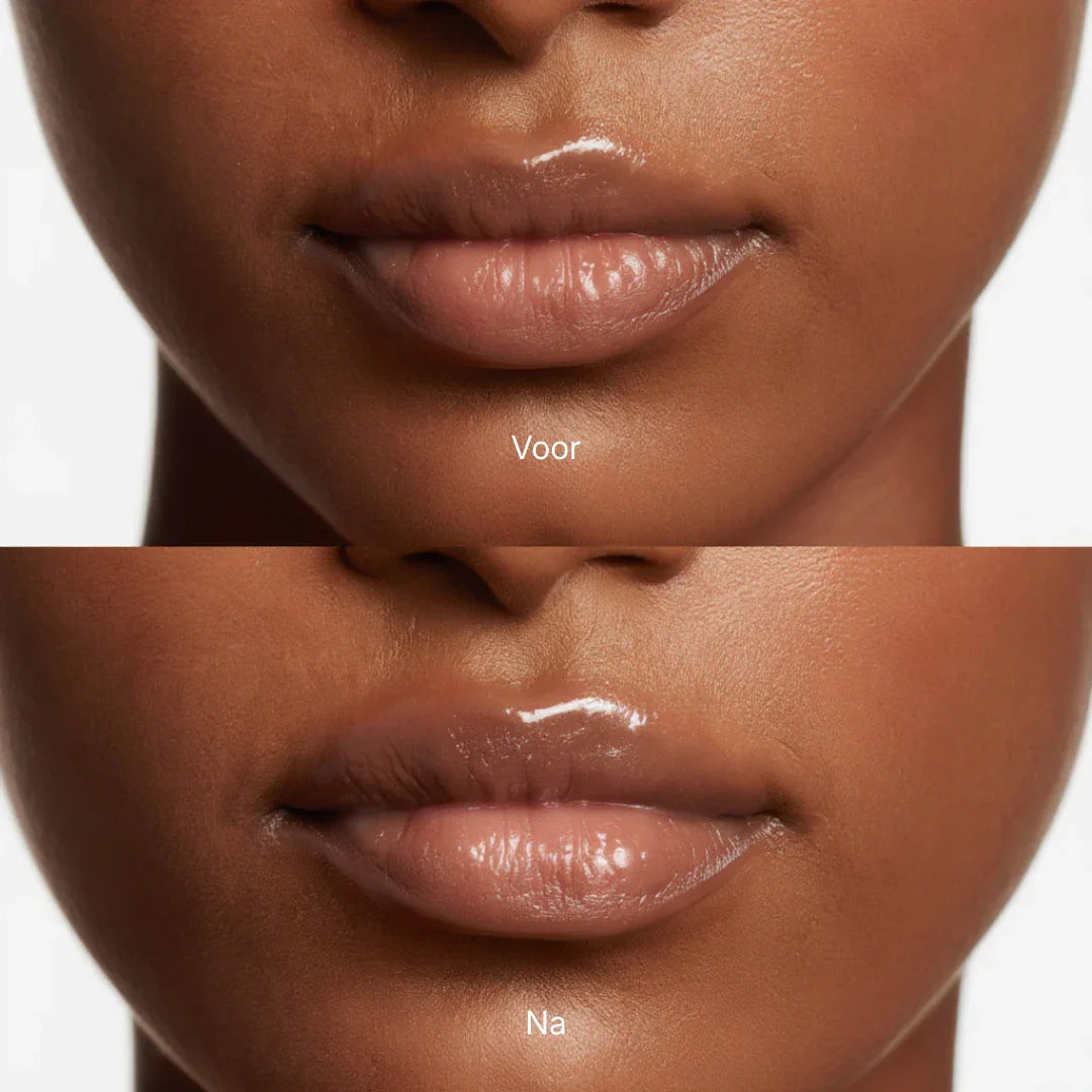 Extreme Lip Plumper